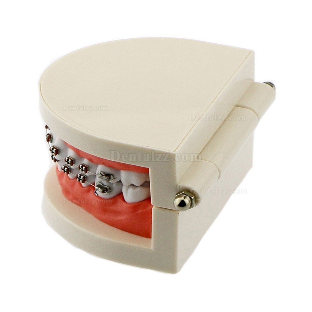 歯科矯正メタルブラケット装置模型 180度開閉式上下額治療説明用歯列模型 白