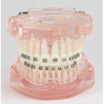 JX®歯科不正咬合歯模型M3001