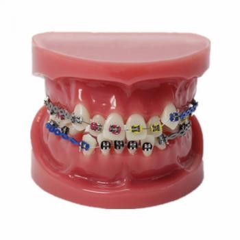 JX®M3005歯科歯列矯正歯模型