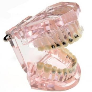 JX®M3009 歯科矯正歯模型