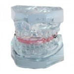 JX®歯模型・口腔模型M3006
