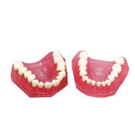 歯科研究治療説明用上下顎義歯模型 高品質脱着可能歯列模型 実用的 クリアベース ピンク