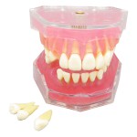 歯科研究治療説明用上下顎義歯模型 高品質脱着可能歯列模型 実用的 クリアベース ピンク