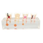 歯科虫歯歯髄炎治療説明用歯列模型 高品質透明虫歯拡大モデル