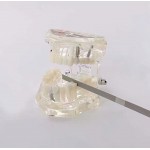 10本歯科精密20-70um 2.5-6mm歯科矯正IPRダイヤモンドストリップ医学砂片面