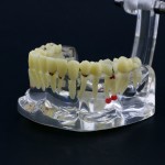 新しい歯科模型 成人病理歯模型 歯列モデル 模型 教学 研究 説明用 #4001