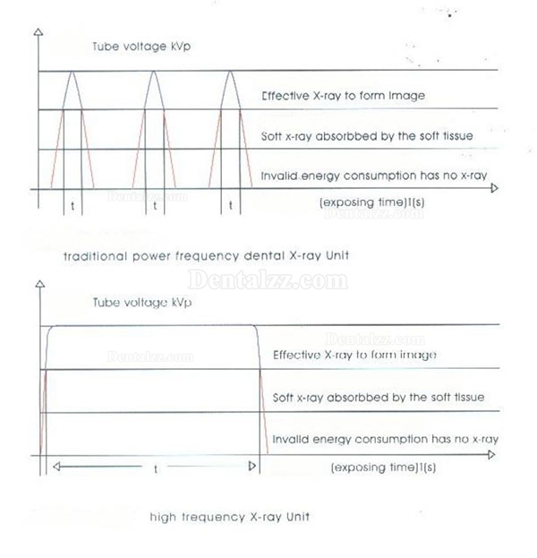 歯科用X線診断照射撮影装置High Frequency