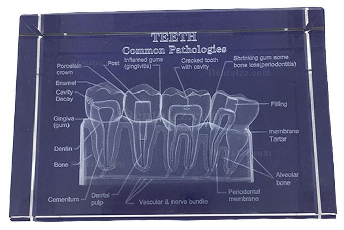 歯科水晶内部歯解剖図嵌め込み 歯科教学水晶置物歯科装飾品プレゼント