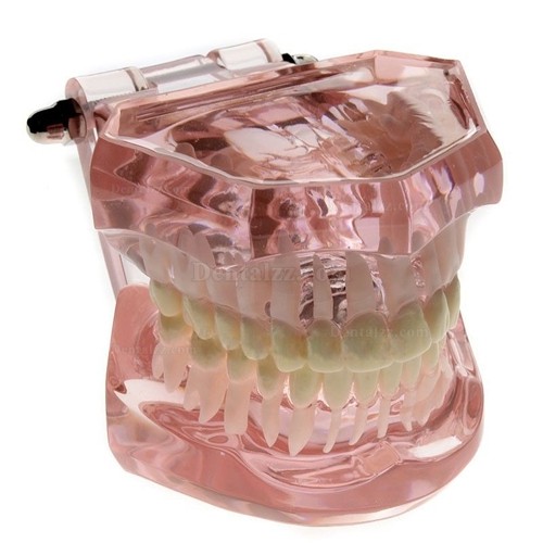 JX®歯科歯列矯正歯模型M3004