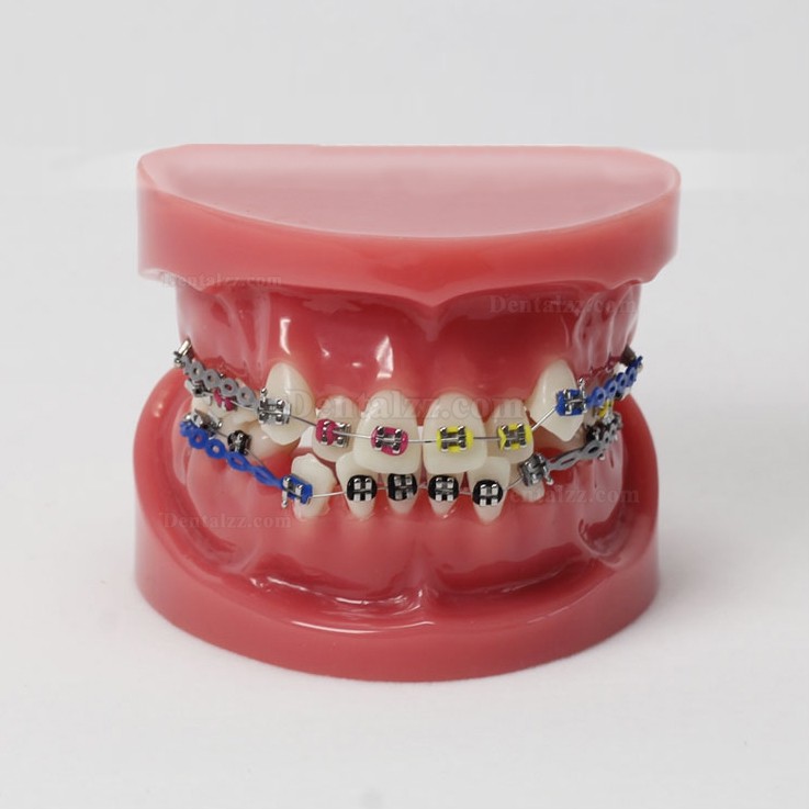 歯科歯列矯正歯模型M3005