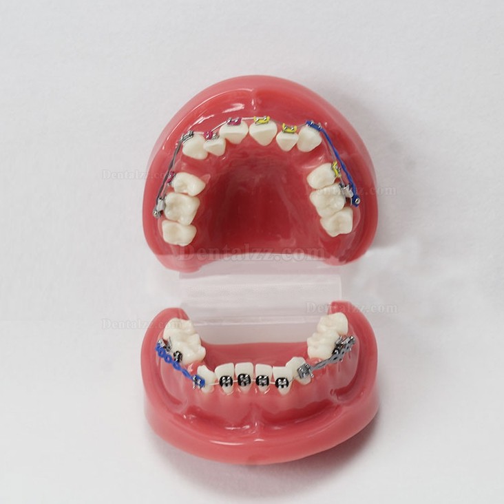 歯科歯列矯正歯模型M3005