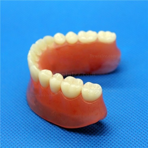 JX®歯科インプラント歯模型M6007