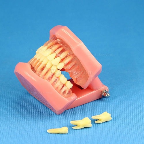 JX®歯科デントリムーバブル標準正歯模型M7005