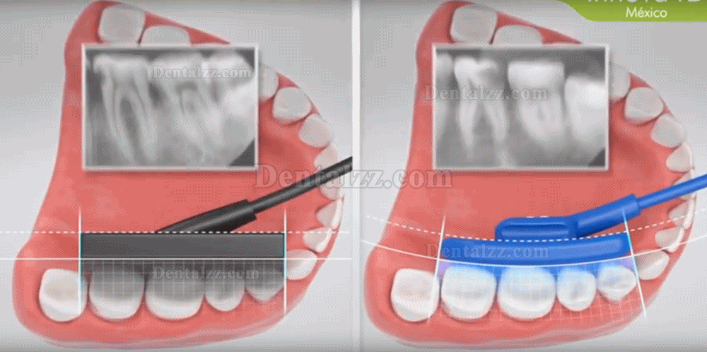 VATECH EZSensor Soft Type Dental X Ray Sensor