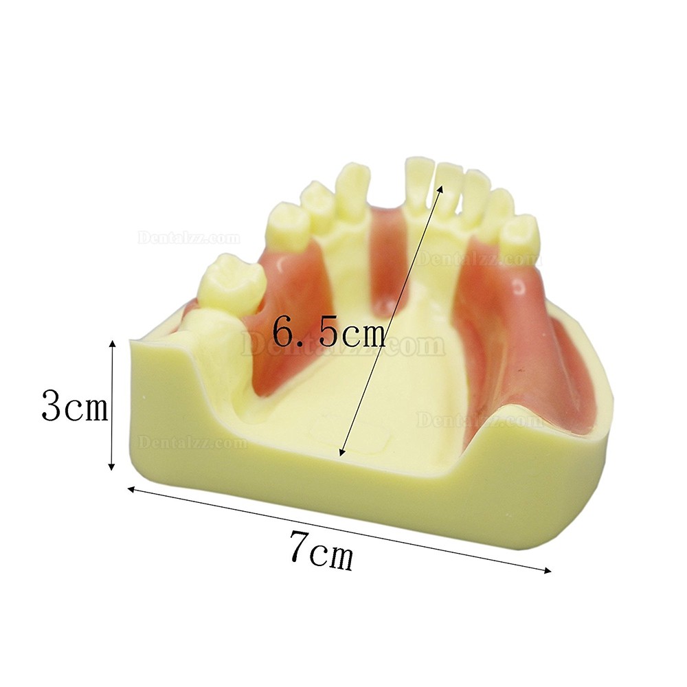 歯科下顎義歯インプラント研究練習用模型 道具 標準教学道具 イエローベース