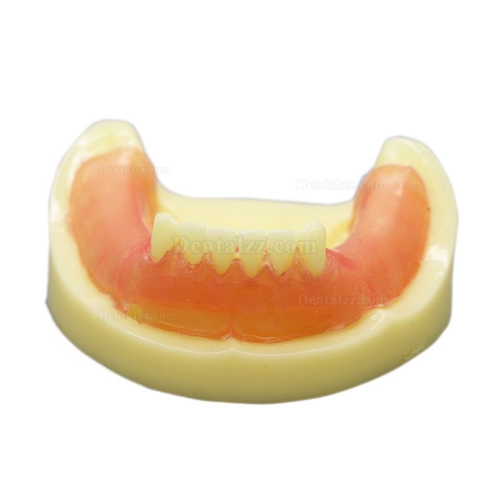 歯科インプラント練習用下顎義歯模型 歯科研究用標準教学道具 イエローベース