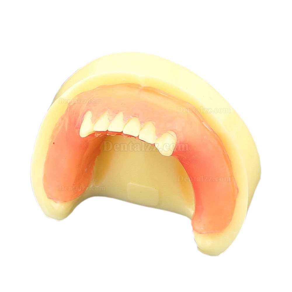 歯科インプラント練習用下顎義歯模型 歯科研究用標準教学道具 イエローベース