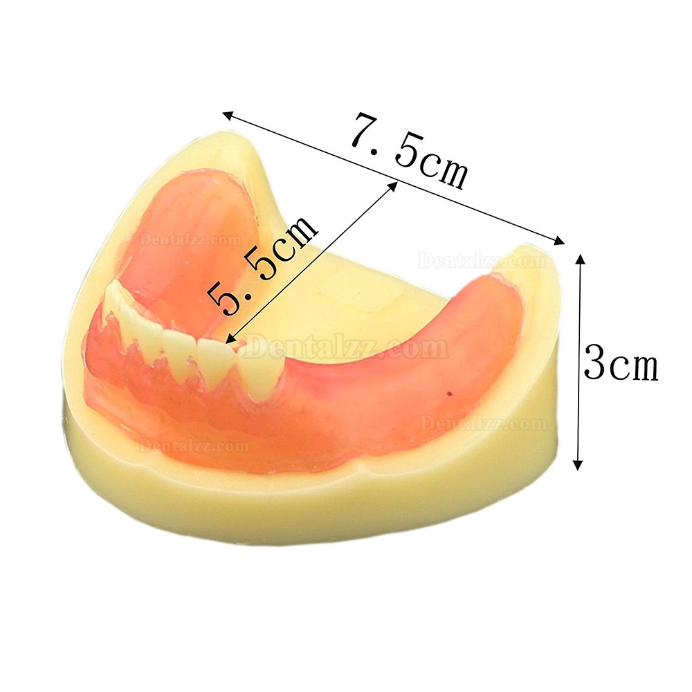 歯科インプラント練習用下顎義歯模型 歯科研究用標準教学道具 イエローベース