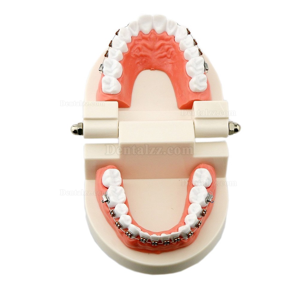 歯科矯正メタルブラケット装置模型 180度開閉式上下額治療説明用歯列模型 白
