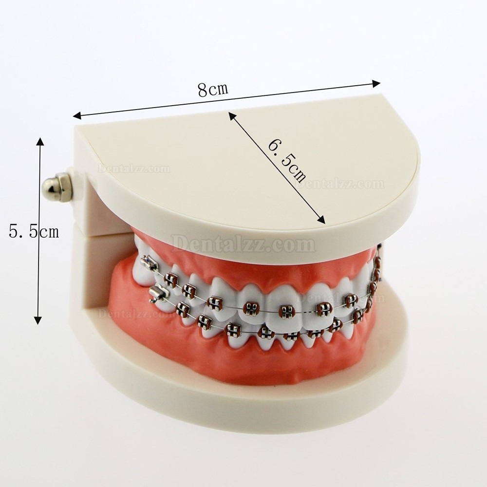 歯科矯正メタルブラケット装置模型 180度開閉式上下額治療説明用歯列模型 白