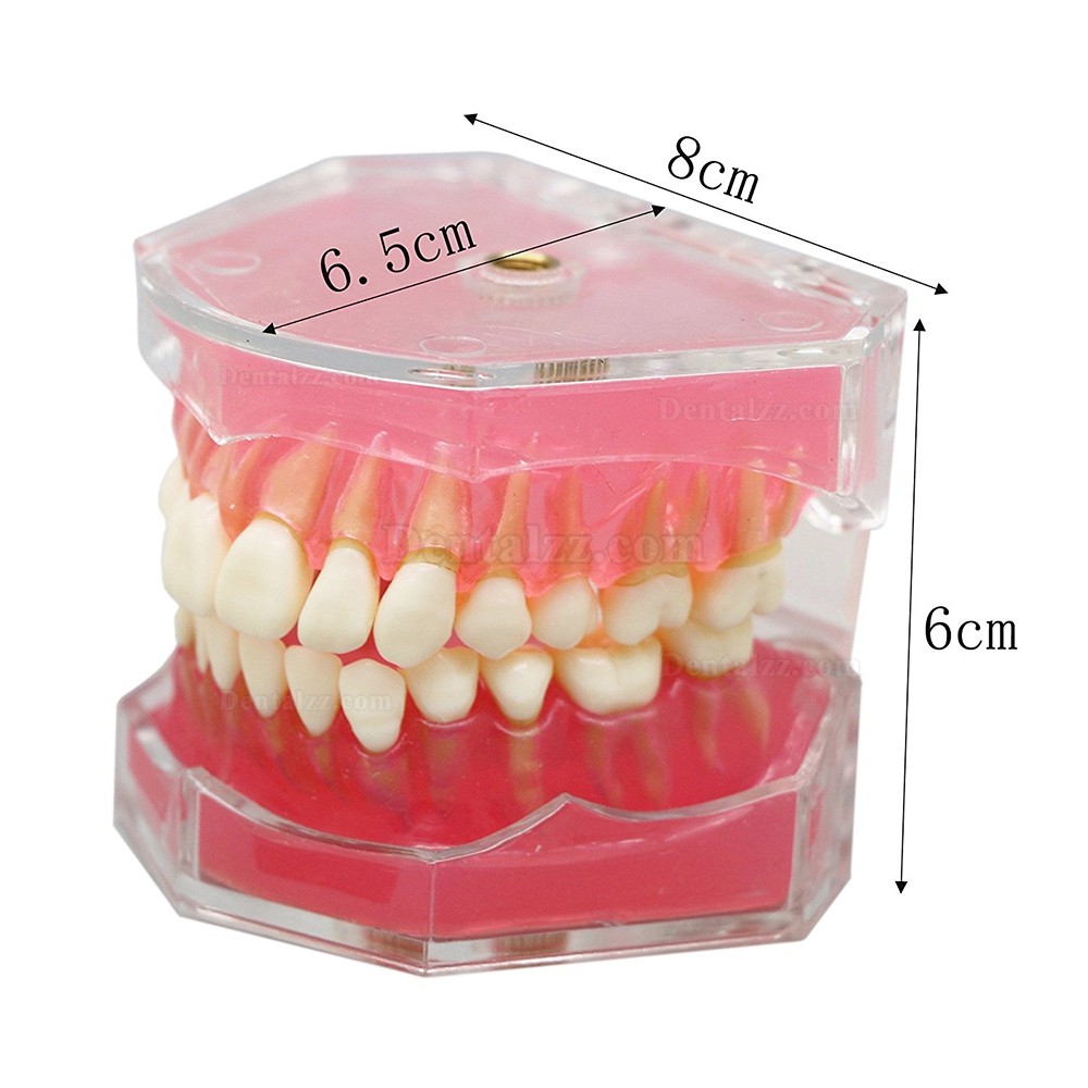 歯科研究治療説明用上下顎義歯模型 高品質脱着可能歯列模型 実用的 クリアベース ピンク