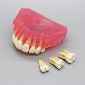 歯科研究治療説明用上下顎義歯模型 高品質脱着可能歯列模型 実用的 クリアベース ピンク