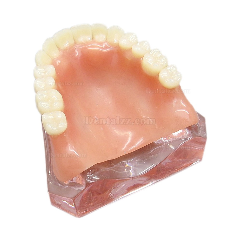 歯科上顎インプラント研究治療説明用歯列モデル模型 4本釘 取り外し可能